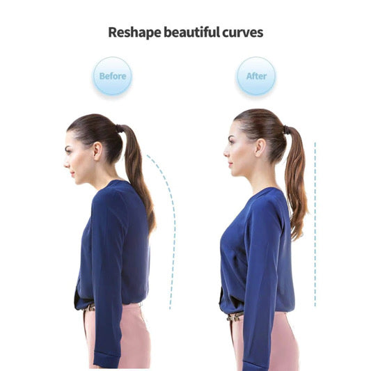 Smart Posture Corrector Device Posture Training Realtime Scientific Back Posture Correct Neck Hump Corrector Adult Kid Health